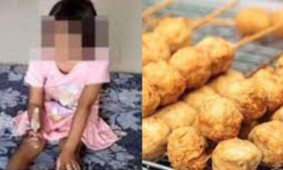 Siswi SD berinisial SAH (8) mengalami kebutaan usai dicolok menggunakan tusuk bakso [tribunnews]