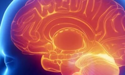 Ilustrasi otak cerdas [malangtimes]