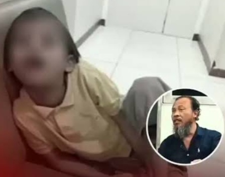 Anak Down Syndrome di Surabaya meninggal diduga akibat dibully 2 anak tetangganya [instagram]